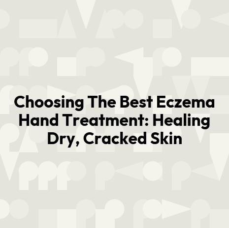Choosing The Best Eczema Hand Treatment: Healing Dry, Cracked Skin