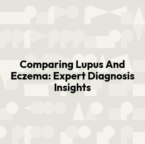 Comparing Lupus And Eczema: Expert Diagnosis Insights