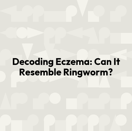 Decoding Eczema: Can It Resemble Ringworm?