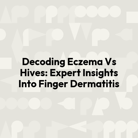 Decoding Eczema Vs Hives: Expert Insights Into Finger Dermatitis