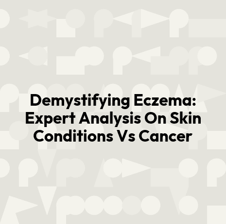 Demystifying Eczema: Expert Analysis On Skin Conditions Vs Cancer