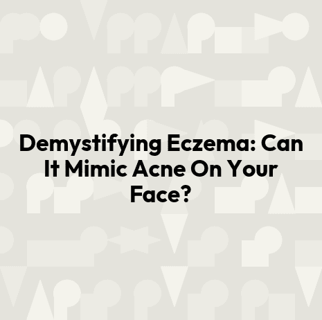 Demystifying Eczema: Can It Mimic Acne On Your Face?