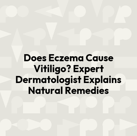 Does Eczema Cause Vitiligo? Expert Dermatologist Explains Natural Remedies