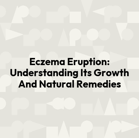 Eczema Eruption: Understanding Its Growth And Natural Remedies