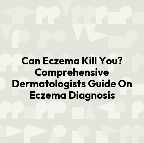 Can Eczema Kill You? Comprehensive Dermatologists Guide On Eczema Diagnosis
