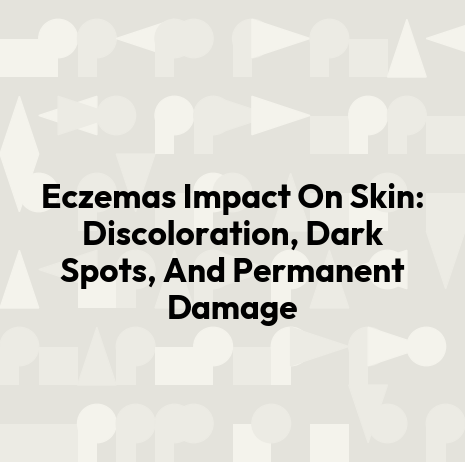 Eczemas Impact On Skin: Discoloration, Dark Spots, And Permanent Damage
