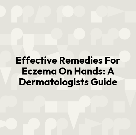 Effective Remedies For Eczema On Hands: A Dermatologists Guide