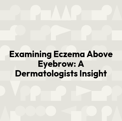 Examining Eczema Above Eyebrow: A Dermatologists Insight