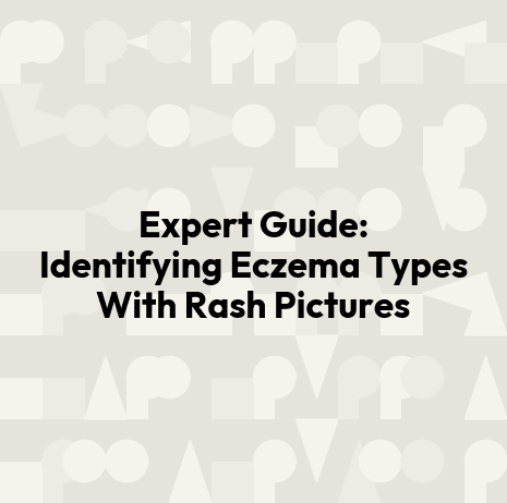 Expert Guide: Identifying Eczema Types With Rash Pictures