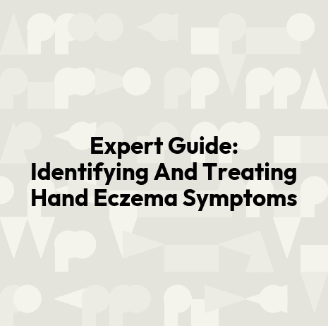 Expert Guide: Identifying And Treating Hand Eczema Symptoms