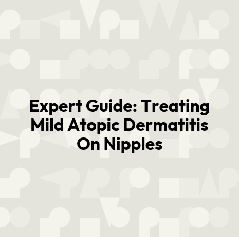 Expert Guide: Treating Mild Atopic Dermatitis On Nipples