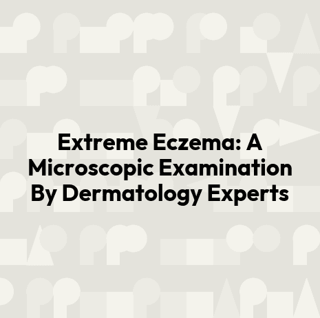 Extreme Eczema: A Microscopic Examination By Dermatology Experts