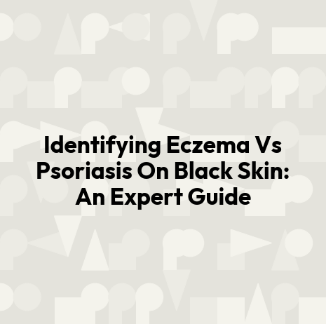 Identifying Eczema Vs Psoriasis On Black Skin: An Expert Guide