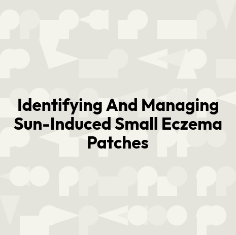 Identifying And Managing Sun-Induced Small Eczema Patches