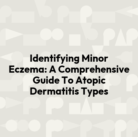 Identifying Minor Eczema: A Comprehensive Guide To Atopic Dermatitis Types