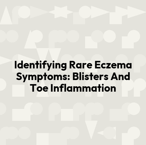 Identifying Rare Eczema Symptoms: Blisters And Toe Inflammation