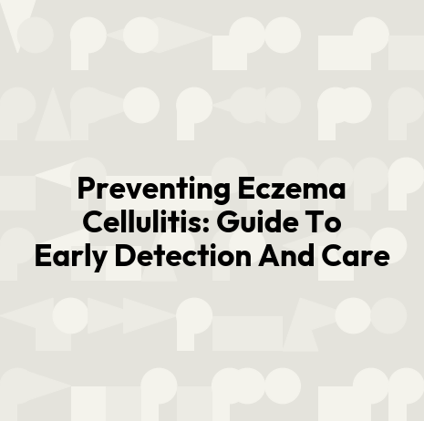 Preventing Eczema Cellulitis: Guide To Early Detection And Care