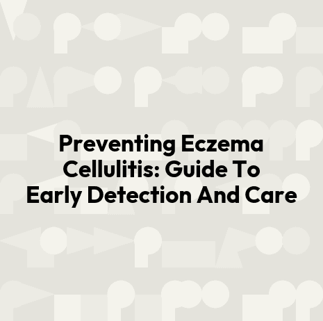 Preventing Eczema Cellulitis: Guide To Early Detection And Care