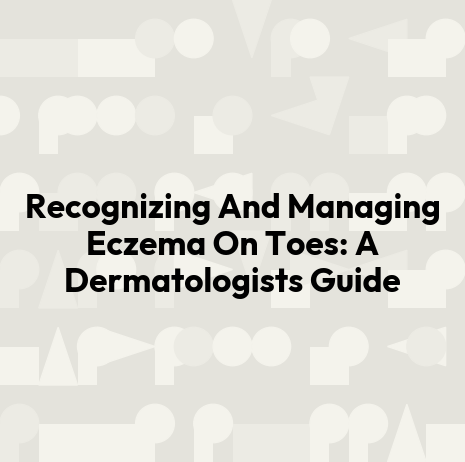 Recognizing And Managing Eczema On Toes: A Dermatologists Guide