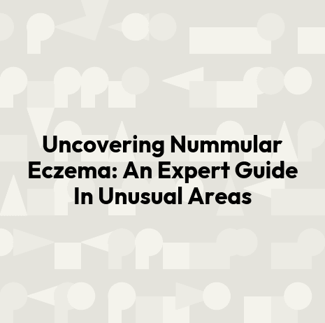Uncovering Nummular Eczema: An Expert Guide In Unusual Areas