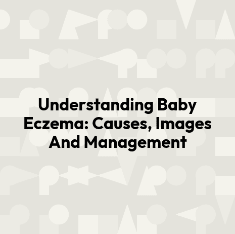 Understanding Baby Eczema: Causes, Images And Management