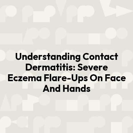 Understanding Contact Dermatitis: Severe Eczema Flare-Ups On Face And Hands