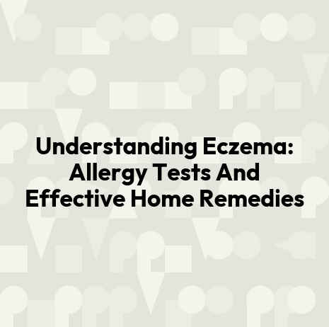 Understanding Eczema: Allergy Tests And Effective Home Remedies