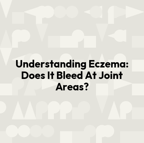 Understanding Eczema: Does It Bleed At Joint Areas?