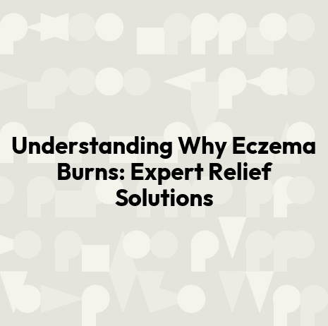 Understanding Why Eczema Burns: Expert Relief Solutions