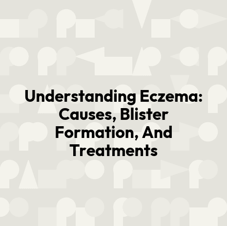 Understanding Eczema: Causes, Blister Formation, And Treatments