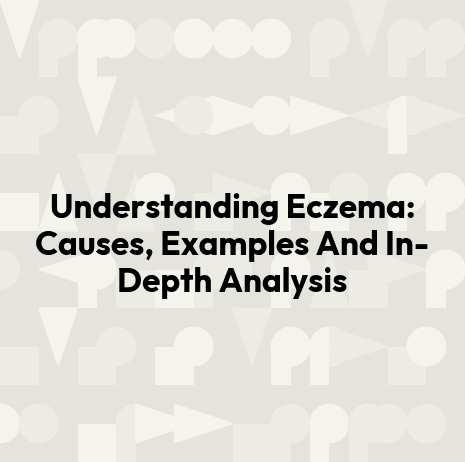 Understanding Eczema: Causes, Examples And In-Depth Analysis