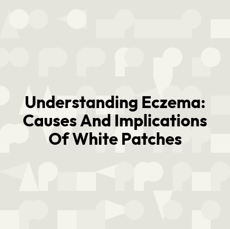 Understanding Eczema: Causes And Implications Of White Patches