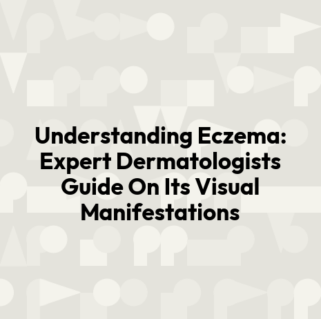 Understanding Eczema: Expert Dermatologists Guide On Its Visual Manifestations