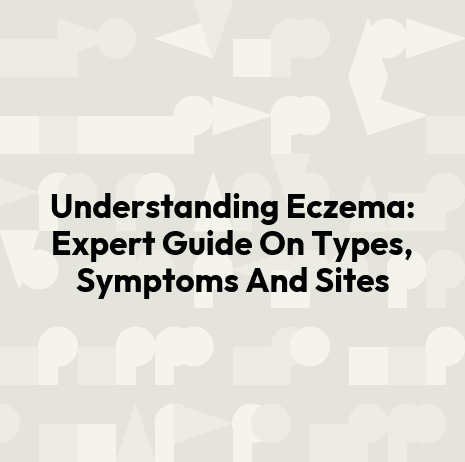 Understanding Eczema: Expert Guide On Types, Symptoms And Sites