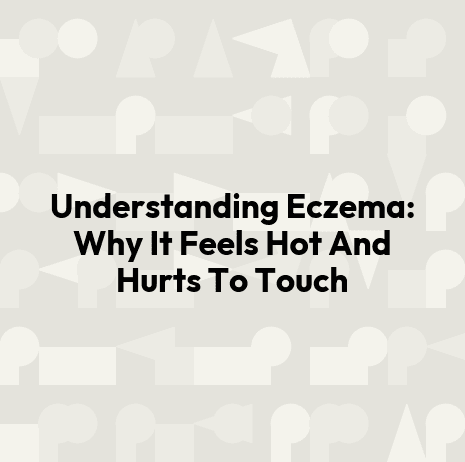 Understanding Eczema: Why It Feels Hot And Hurts To Touch