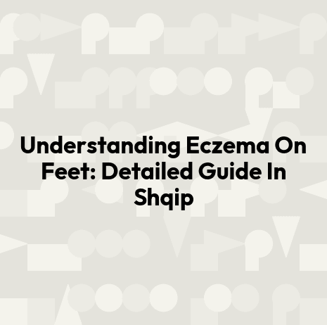 Understanding Eczema On Feet: Detailed Guide In Shqip