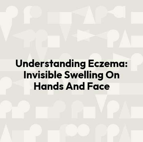 Understanding Eczema: Invisible Swelling On Hands And Face