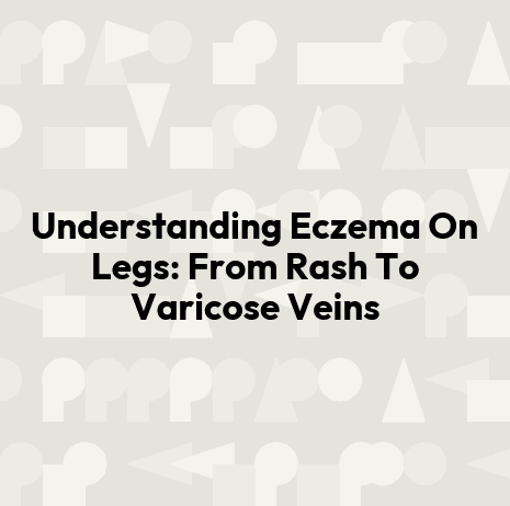 Understanding Eczema On Legs: From Rash To Varicose Veins