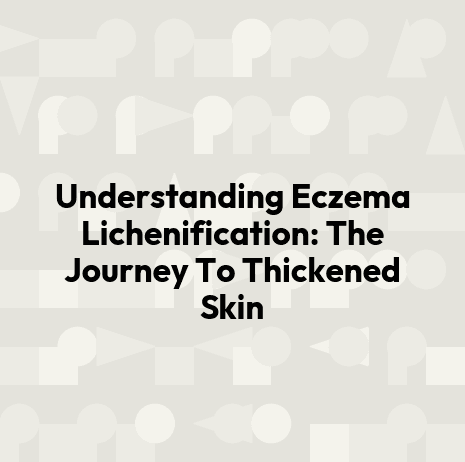 Understanding Eczema Lichenification: The Journey To Thickened Skin