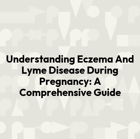 Understanding Eczema And Lyme Disease During Pregnancy: A Comprehensive Guide