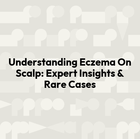 Understanding Eczema On Scalp: Expert Insights & Rare Cases