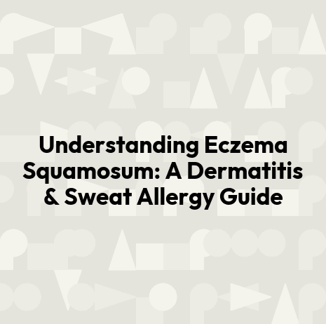 Understanding Eczema Squamosum: A Dermatitis & Sweat Allergy Guide
