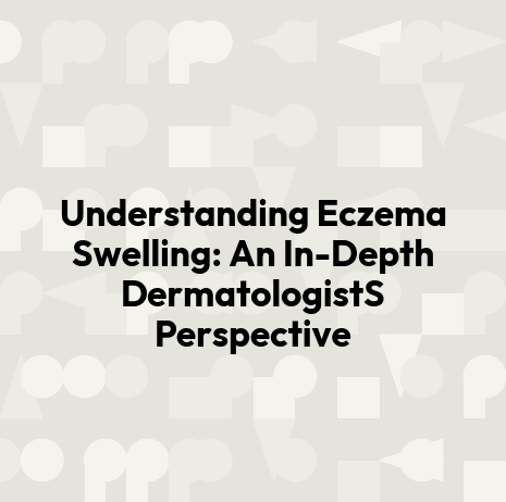 Understanding Eczema Swelling: An In-Depth DermatologistS Perspective