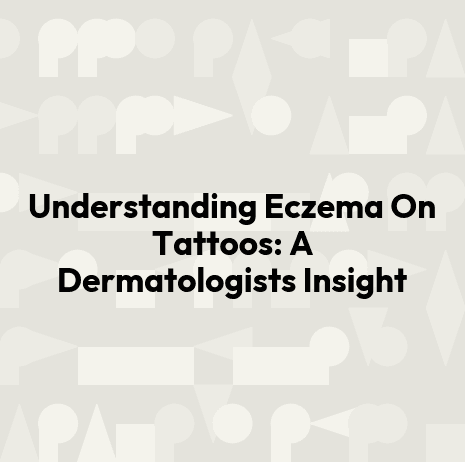 Understanding Eczema On Tattoos: A Dermatologists Insight