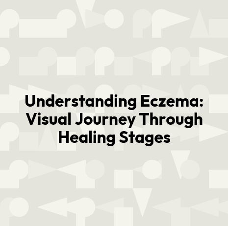 Understanding Eczema: Visual Journey Through Healing Stages