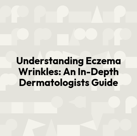 Understanding Eczema Wrinkles: An In-Depth Dermatologists Guide