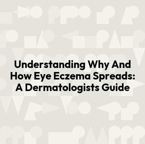 Understanding Why And How Eye Eczema Spreads: A Dermatologists Guide
