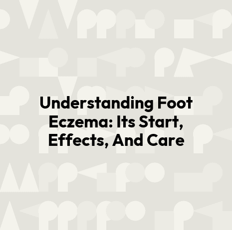 Understanding Foot Eczema: Its Start, Effects, And Care