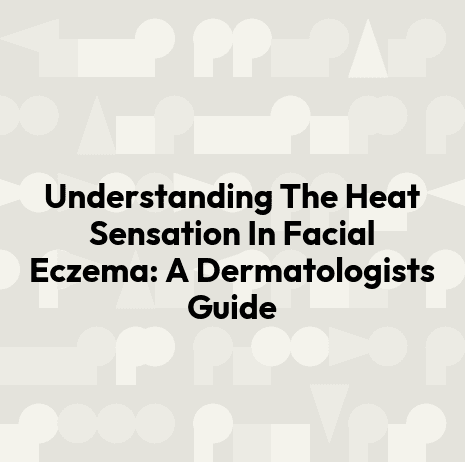 Understanding The Heat Sensation In Facial Eczema: A Dermatologists Guide
