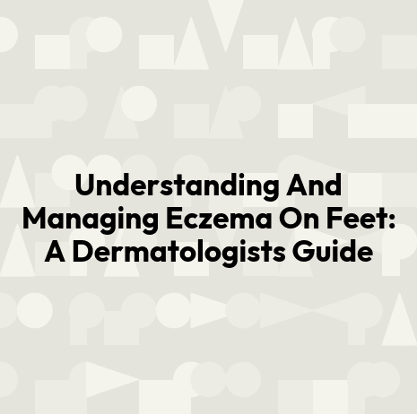 Understanding And Managing Eczema On Feet: A Dermatologists Guide